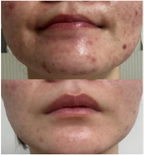 Medi-Pair Plasma Serum (Pre-Order Only)