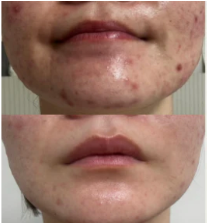 Medi-Pair Plasma Serum (Pre-Order Only)