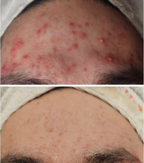 Medi-Pair Plasma Serum (Pre-Order Only)