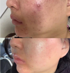 Medi-Pair Plasma Serum (Pre-Order Only)